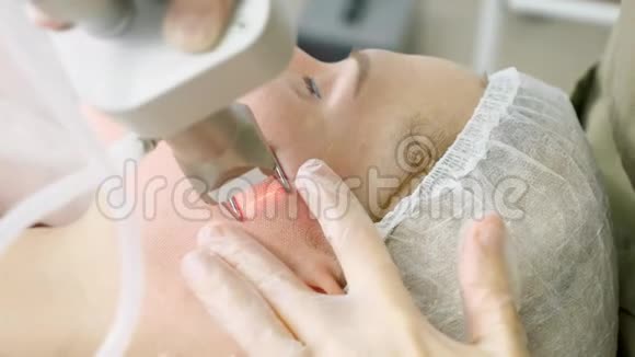 治疗师在病人脸上做激光脱毛手术视频的预览图