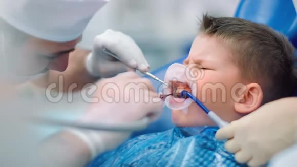 在口腔科把男医生美白牙齿贴到小男孩身上4k龙红相机视频的预览图