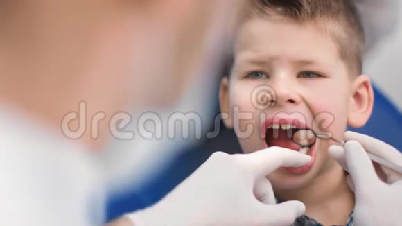 在定期的牙医检查中用健康的牙齿把有吸引力的男孩的脸闭上4k龙红相机视频的预览图