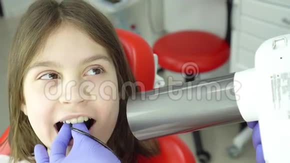 X光治疗牙齿龋齿的诊断牙科的现代技术儿童牙科视频的预览图