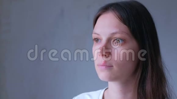 上唇疱疹病毒疼痛的患病妇女的肖像视频的预览图