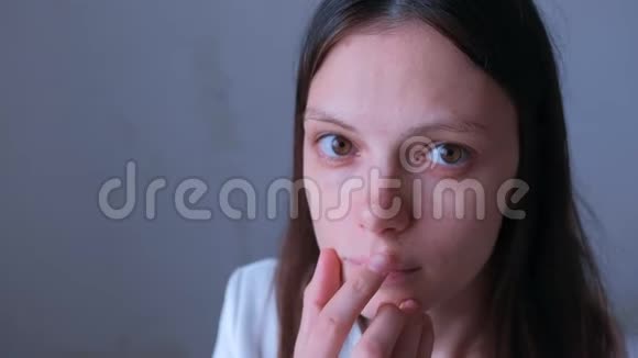 女人的肖像用药膏涂抹她的唇部疼痛因为疱疹感染视频的预览图