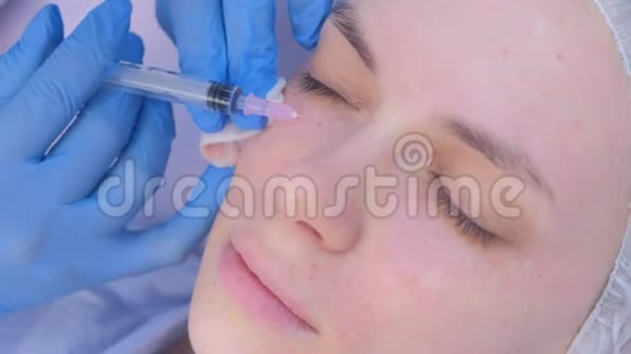 美容师在女性面部皮肤上进行多次注射生物数字化视频的预览图