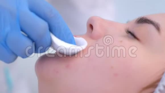 美容师擦拭棉垫嘴唇在永久嘴唇程序为妇女视频的预览图