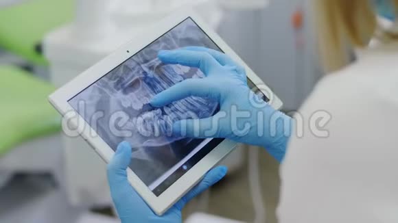 便携式仪器上牙齿的X光视频的预览图