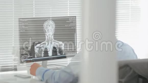 移植医生在电脑上检查大脑的图片视频的预览图