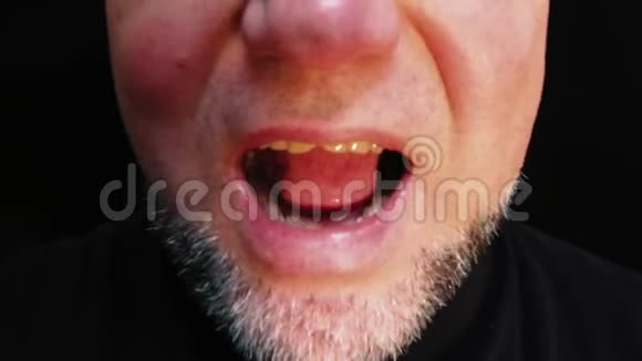 愤怒的男人牙齿歪歪扭扭的人的近嘴视频的预览图