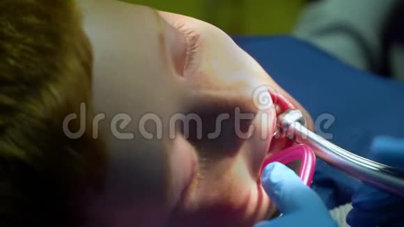 牙医治疗一个受惊的红头发男孩的牙齿视频的预览图