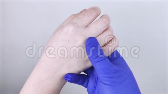 手干及皮肤脱皮真菌病那个女孩向医生皮肤科医生举手滋润双手治疗视频的预览图