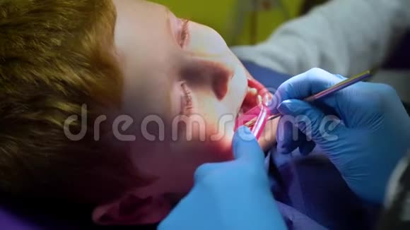 坐在牙科椅上的牙医接待处吓坏了的红发男孩在哭儿童牙科视频的预览图