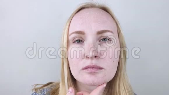 一个女人检查她脸上干燥的皮肤脱皮粗化不适皮肤敏感有皮肤病的病人视频的预览图