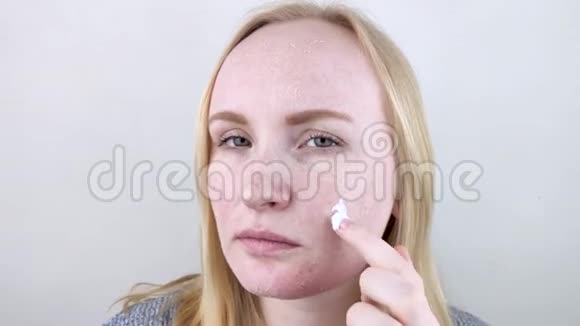 一个皮肤干燥有问题的女孩站在镜子前擦润肤霜身体护理和皮肤干燥的概念视频的预览图