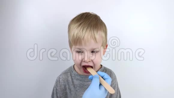 耳鼻喉科医生用木铲检查儿童喉咙可能的诊断是咽炎扁桃体发炎视频的预览图
