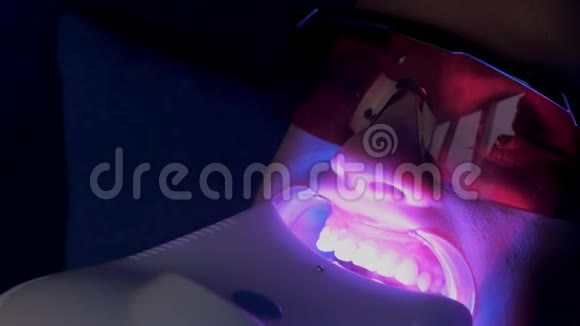 在牙科工作室为女性牙齿做LED美白美容手术特写视频的预览图
