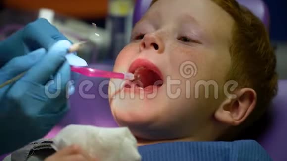 牙医治疗一个受惊的红头发男孩的牙齿视频的预览图