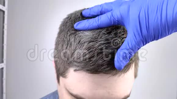 医生戴蓝色医用手套检查一个年轻人的白发青少年早期染发的概念视频的预览图