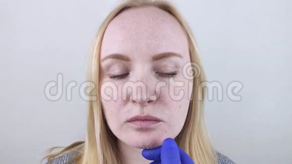 一位戴蓝色医疗手套的医生触摸病人干燥的皮肤以评估皮肤的损害视频的预览图