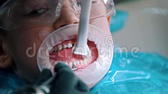 一个在牙科诊所接受清洁治疗的小男孩用吸管收集水视频的预览图