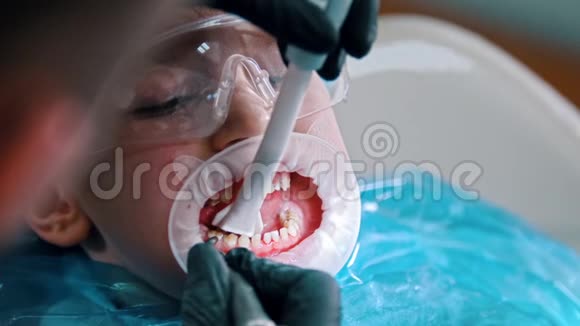 一个小男孩在现代牙科中进行清洁治疗用吸管从口腔中收集水视频的预览图