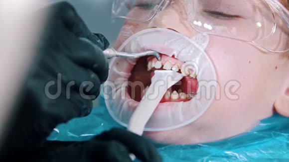 一个戴防护眼镜的小男孩在牙科里进行牙齿清洁治疗用吸管收集水视频的预览图