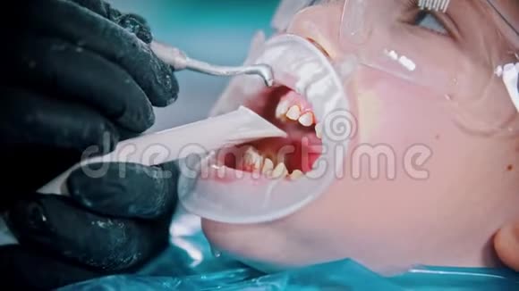 一个牙齿受损的小男孩在牙科治疗用喷水清洗牙齿视频的预览图