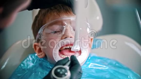 一个牙齿受损的小男孩在牙医诊所用一个开口保护视频的预览图