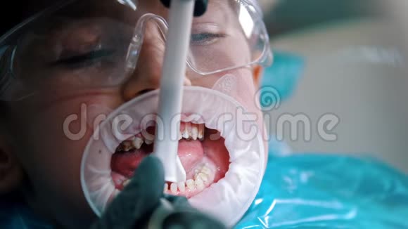 一个在牙科诊所接受清洁治疗的小男孩视频的预览图