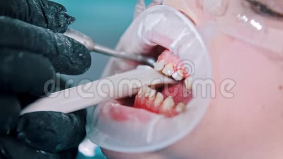 一个戴防护眼镜的小男孩带着婴儿牙齿在牙科诊所做牙齿清洁治疗收集视频的预览图