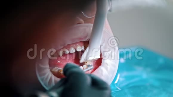 一个在牙科诊所接受清洁治疗的小男孩用吸管从嘴里收集水视频的预览图