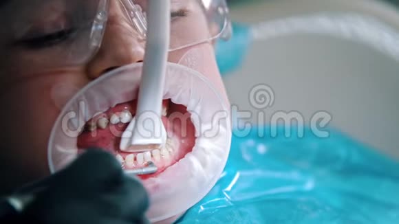 一个带着婴儿牙齿的小男孩在牙科诊所接受清洁治疗视频的预览图
