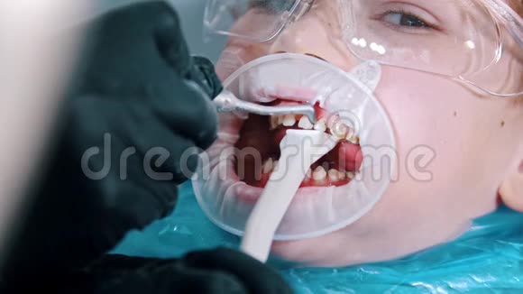 一个戴防护眼镜的小男孩在牙科诊所进行牙齿清洁治疗用一个视频的预览图