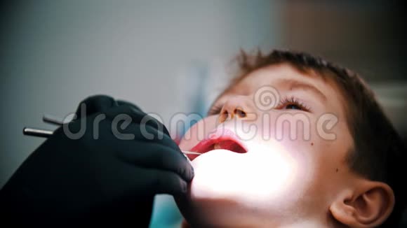 一个牙齿受损的小男孩在现代牙科治疗口腔检查视频的预览图