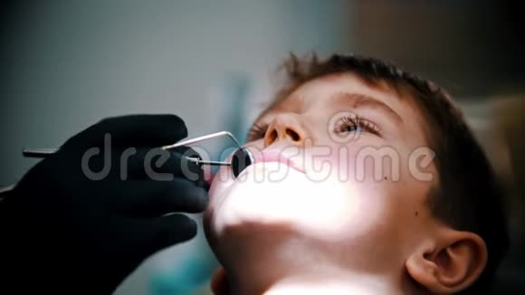 一个婴儿牙齿受损的小男孩在现代牙科治疗牙齿视频的预览图