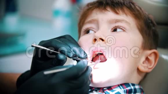 一个小男孩带着婴儿牙齿在现代牙科治疗口腔检查视频的预览图