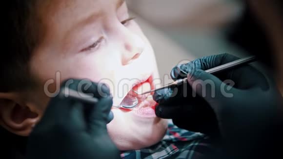 一个带着婴儿牙齿的小男孩在牙科治疗用镜子检查口腔视频的预览图