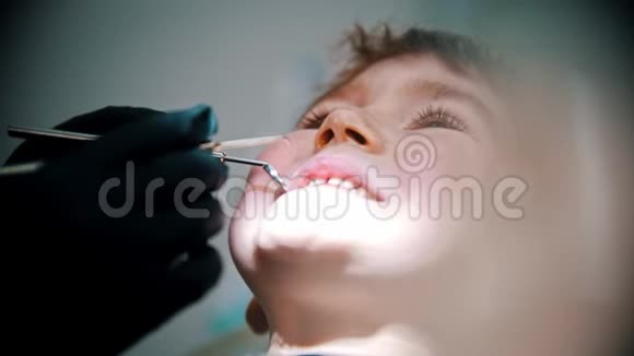 一个牙齿受损的小男孩在牙科治疗视频的预览图