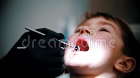 一个牙齿受损的小男孩在现代牙科治疗视频的预览图