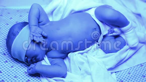 家床紫外线灯治疗黄疸的新生儿视频的预览图