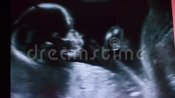 人类胚胎的照片视频的预览图