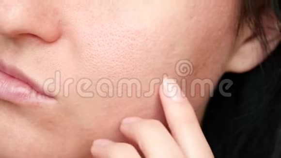 皮肤质地毛孔扩大女人脸特写视频的预览图