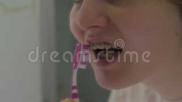 女孩刷牙套视频的预览图
