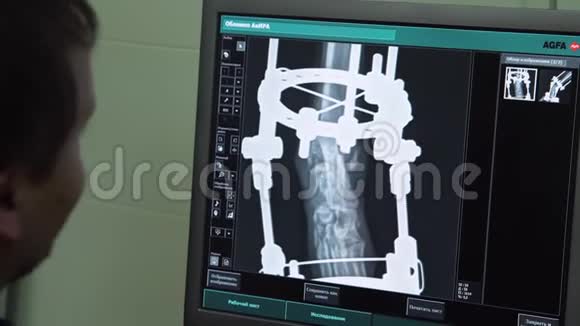 医生在医院看X光视频的预览图