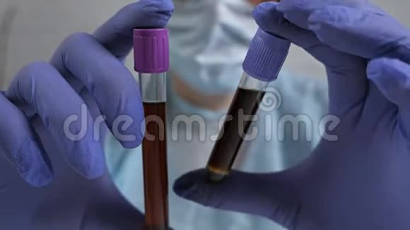 冠状病毒感染血液与纯血的比较医生观察冠状病毒对疫苗的反应视频的预览图