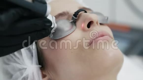 特写美容师用专用设备对女性面部进行激光血管切除术视频的预览图