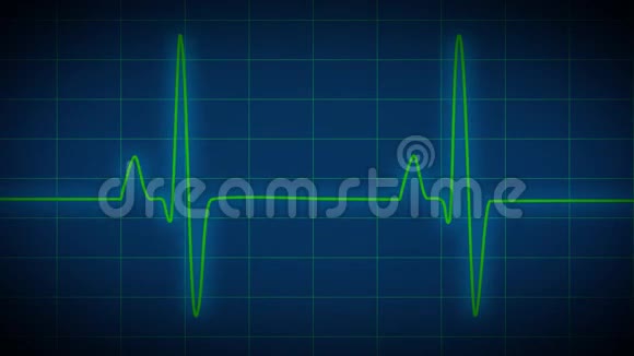 心脏监视器心电图视频的预览图