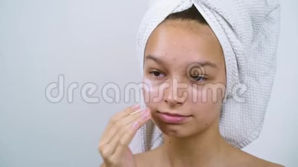 可爱的少女脸上长痘淋浴后涂抹保湿霜视频的预览图