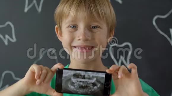 一个奶牙缺失的小男孩的特写镜头显示了他的x光牙齿图片儿童换牙的概念视频的预览图