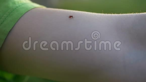 穿绿色t恤的人杀死手上的小蚊子视频的预览图
