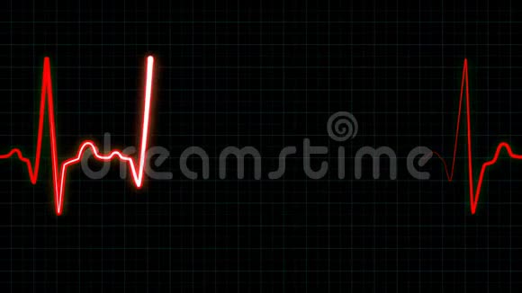 心跳线循环动画视频的预览图