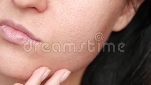 女性面部特写毛孔粗大问题皮肤的纹理那女人用手摸着她脸上的皮肤视频的预览图